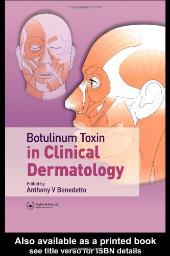 Botulinum Toxin in Clinical Dermatology