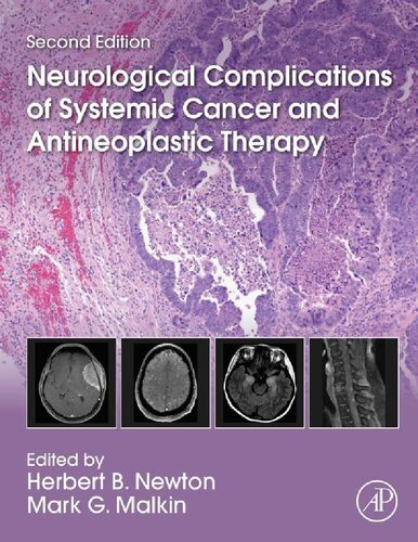 Neurological Complications of Systemic Cancer and Antineoplastic Therapy 2e Herbert B. Newton (editor), Mark G. Malkin (editor)
