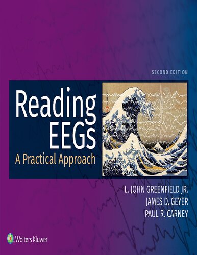 Reading EEGs: A Practical Approach, 2nd Edition
