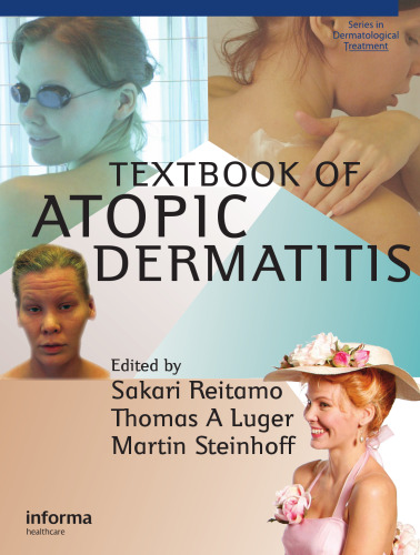 Textbook of Atopic Dermatitis