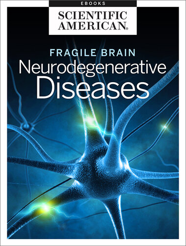 Fragile Brain: Neurodegenerative Diseases