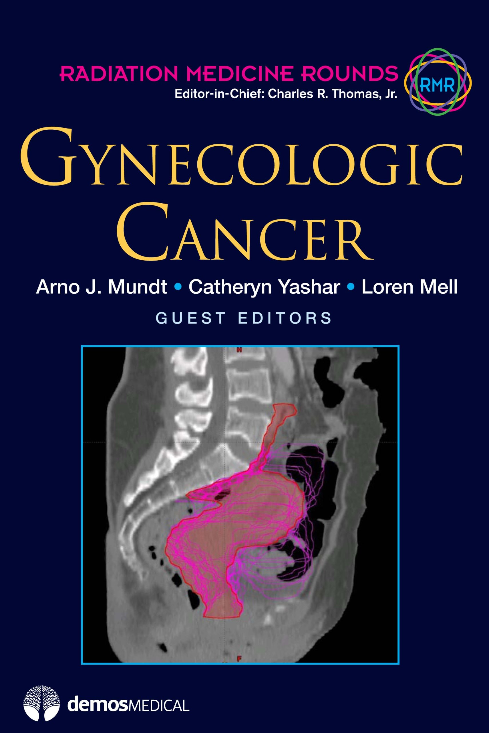 Gynecologic Cancer (Radiation Medicine Rounds, Volume 2, Issue 3)