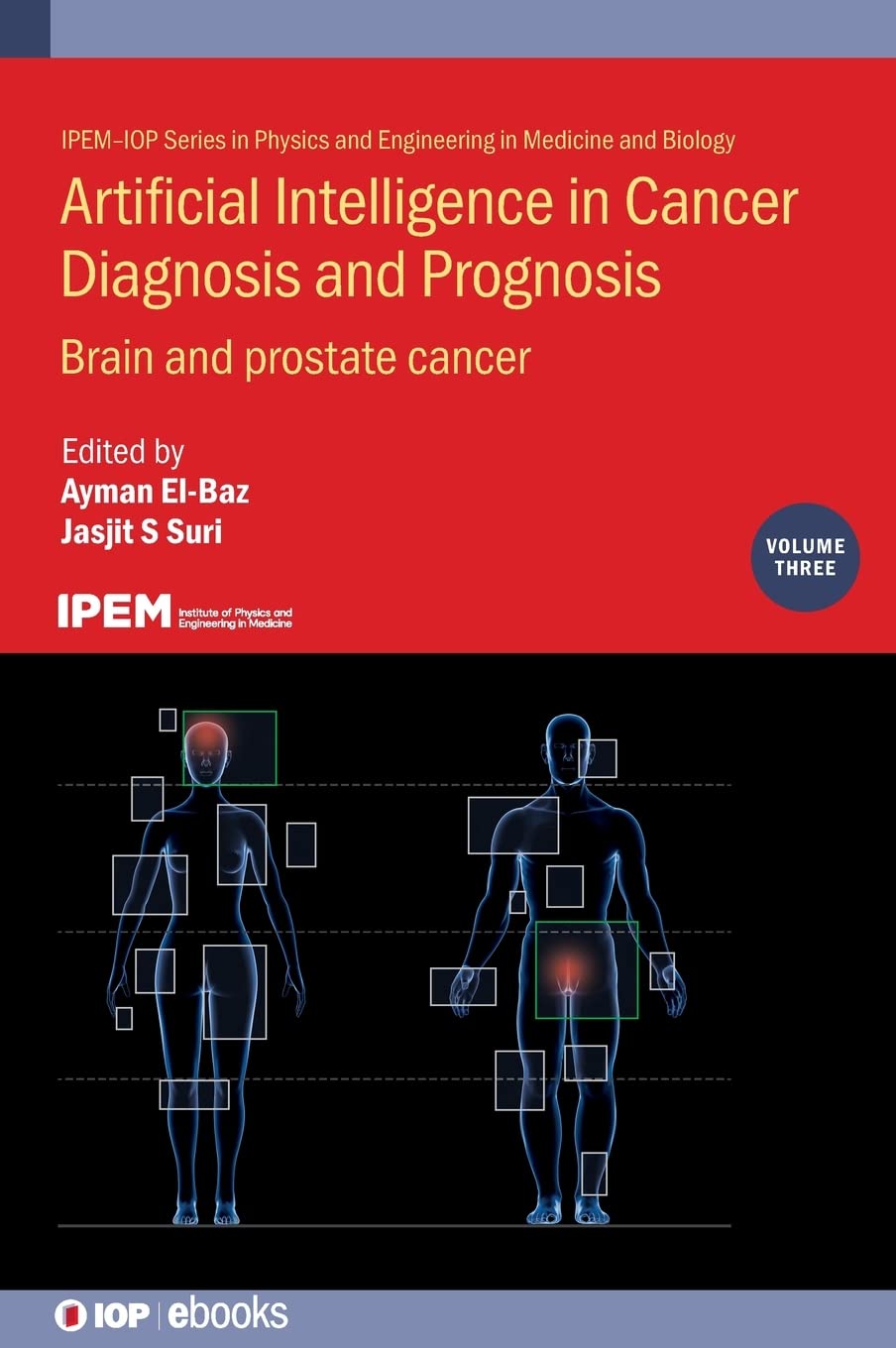 Artificial Intelligence in Cancer Diagnosis and Prognosis, Volume 3: Brain and prostate cancer