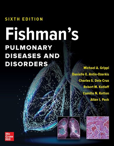 Fishman's Pulmonary Diseases and Disorders, 2-Volume Set