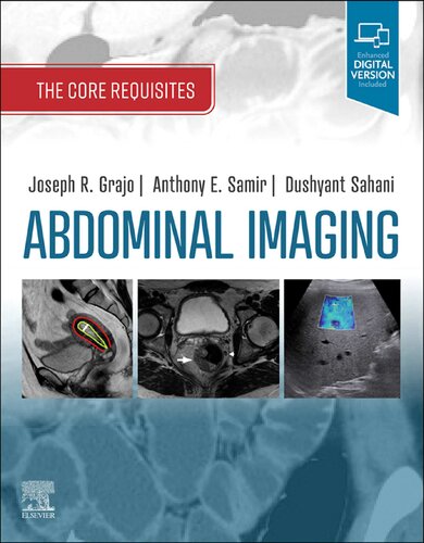 Abdominal Imaging: The Core Requisites, 1e (2021)
