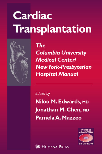 Cardiac Transplantation