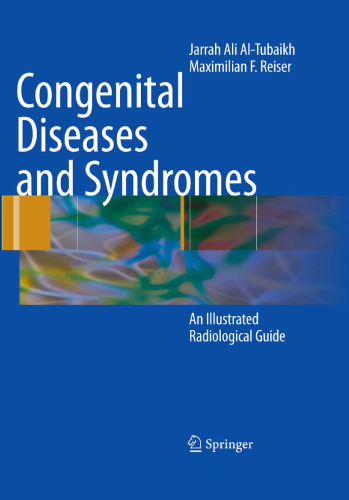 Congenital Diseases and Syndromes: An Illustrated Radiological Guide