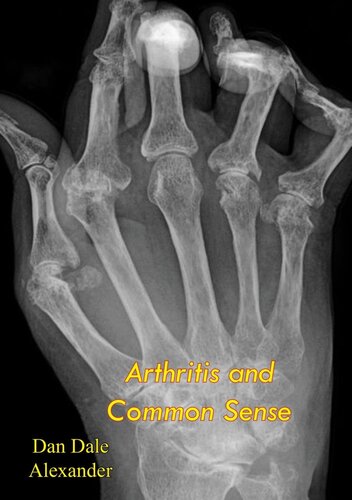Arthritis and Common Sense