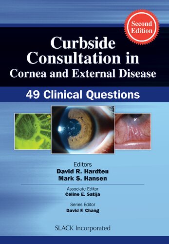Curbside Consultation in Cornea and External Disease: 49 Clinical Questions