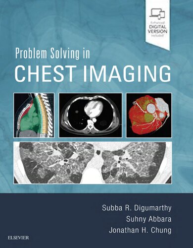 Problem Solving in Chest Imaging (2019)