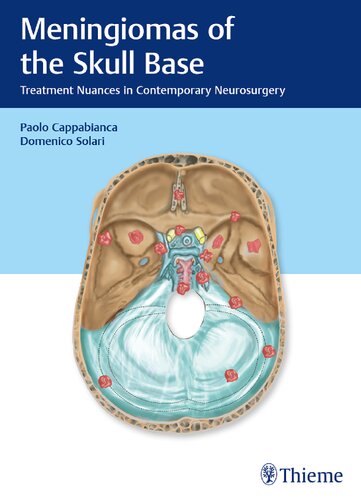 Meningiomas of the Skull Base: Treatment Nuances in Contemporary Neurosurgery