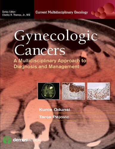 Gynecologic Cancers A. Multidisciplinary Approach to Diagnosis and Management