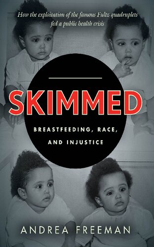 Skimmed: Breastfeeding, Race, and Injustice