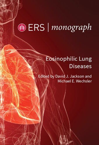 Eosinophilic Lung Disease