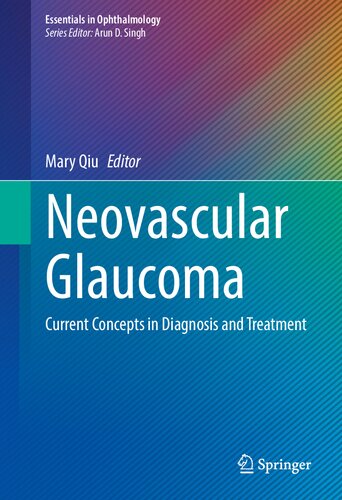 Neovascular Glaucoma: Current Concepts in Diagnosis and Treatment