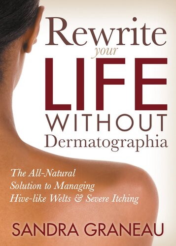 Rewrite Your Life Without Dermatographia: The All-Natural Solution to Managing Hive-like Welts and Severe Itching