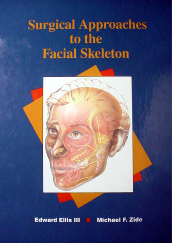 Surgical Approaches to the Facial Skeleton