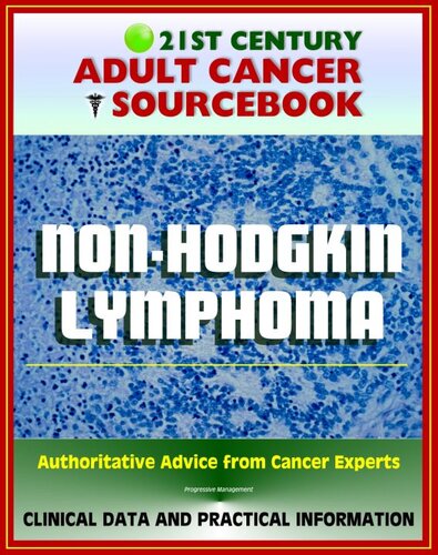 21st Century Adult Cancer Sourcebook: Non-Hodgkin Lymphoma (NHL) including Burkitt Lymphoma and Others--Clinical Data for Patients, Families, and Physicians