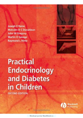 Practical Endocrinology and Diabetes in Children
