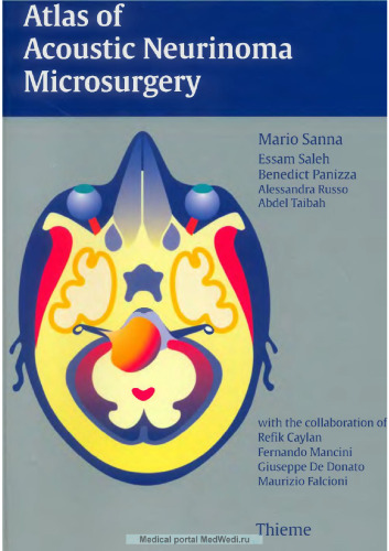 Atlas of Acoustic Neurinoma Microsurgery