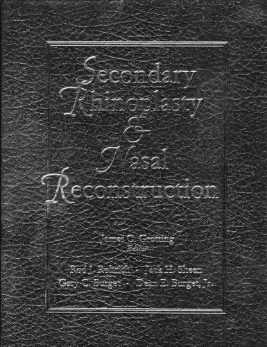 Secondary Rhinoplasty And Nasal Reconstruction