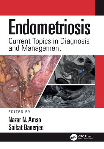 Endometriosis: Current Topics in Diagnosis and Management