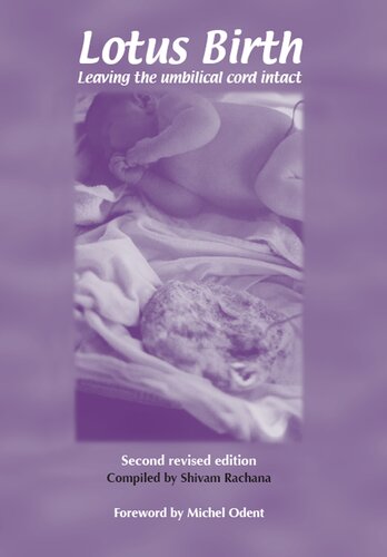 Lotus Birth: Leaving the Umbilical Cord Intact