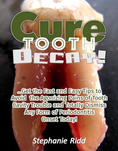Cure Tooth Decay!: Get the Fast and Easy Tips to Avoid the Agonizing Pains of Tooth Cavity Trouble and Totally Dismiss Any Form of Periodontitis Onset Today!