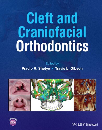Cleft and Craniofacial Orthodontics
