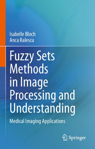 Fuzzy Sets Methods in Image Processing and Understanding: Medical Imaging Applications