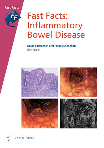 Fast Facts: Inflammatory Bowel Disease