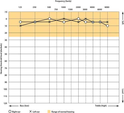 Mayo Clinic on Better Hearing and Balance