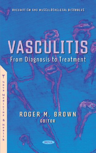 Vasculitis: From Diagnosis to Treatment