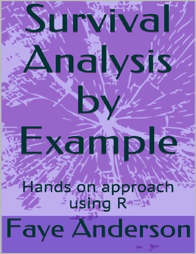 Survival Analysis by Example: Hands on approach using R