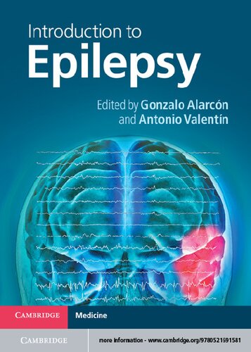 Introduction to Epilepsy