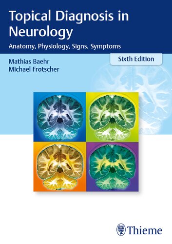 Topical Diagnosis in Neurology: Anatomy, Physiology, Signs, Symptoms