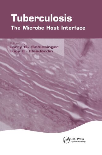 Tuberculosis: The Microbe Host Interface