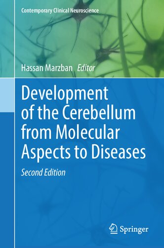 Development of the Cerebellum from Molecular Aspects to Diseases
