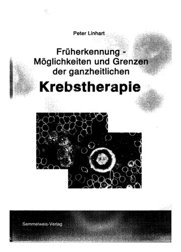 Früherkennung - Möglichkeiten und Grenzen der ganzheitlichen Krebstherapie