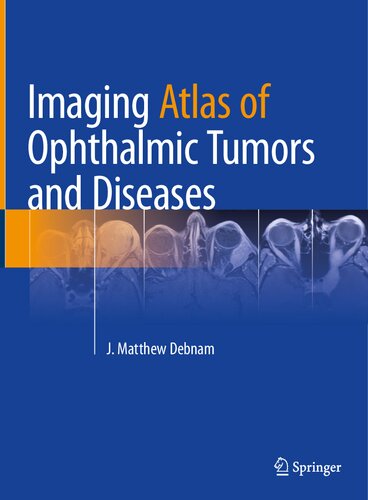 Imaging Atlas of Ophthalmic Tumors and Diseases