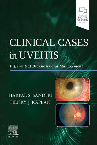 Clinical Cases in Uveitis: Differential Diagnosis and Management