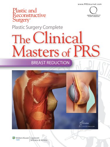 Plastic Surgery Complete: The Clinical Masters of PRS: Breast Reduction