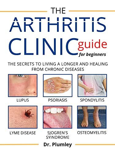 The Arthritis Clinic Guide for Beginners: The secret to living a longer and healing from chronic disease, such as: lupus, Psoriasis, Spondylitis, Lyme ... Sjogren's syndrome, osteoarthritis, etc.