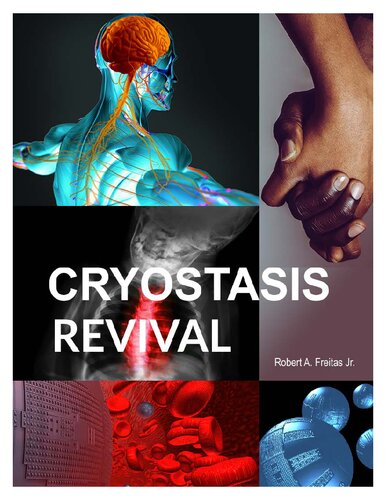 Cryostasis Revival: The Recovery of Cryonics Patients through Nanomedicine