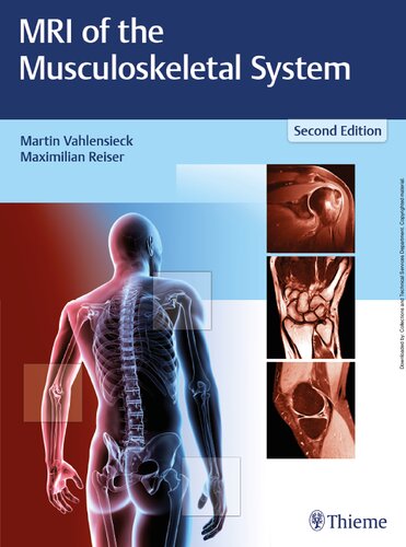 MRI of the Musculoskeletal System
