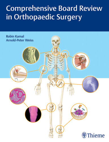 Comprehensive Board Review in Orthopaedic Surgery