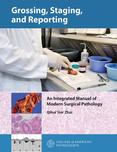 Grossing, staging and reporting