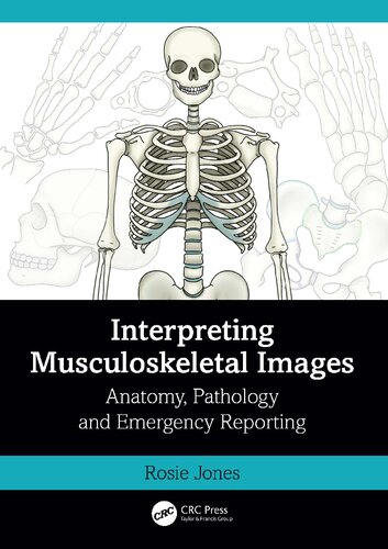 Interpreting Musculoskeletal Images: Anatomy, Pathology and Emergency Reporting