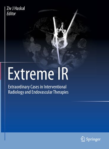 Extreme IR: Extraordinary Cases in Interventional Radiology and Endovascular Therapies