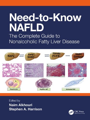Need-to-Know NAFLD: The Complete Guide to Nonalcoholic Fatty Liver Disease (by Team-IRA)